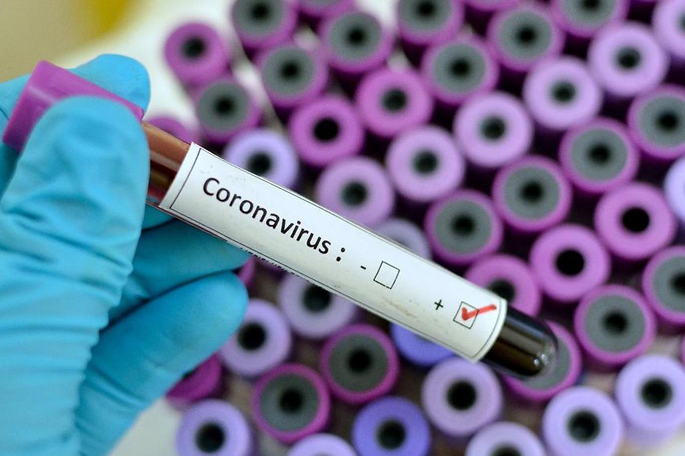 Russia’s death toll from coronavirus rises to 10,843